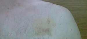qmph-cribado-mamografia--cinturón-seguridad