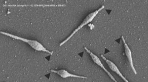qmph-blog--sindrome-toxico--mycoplasma-phneumoniae